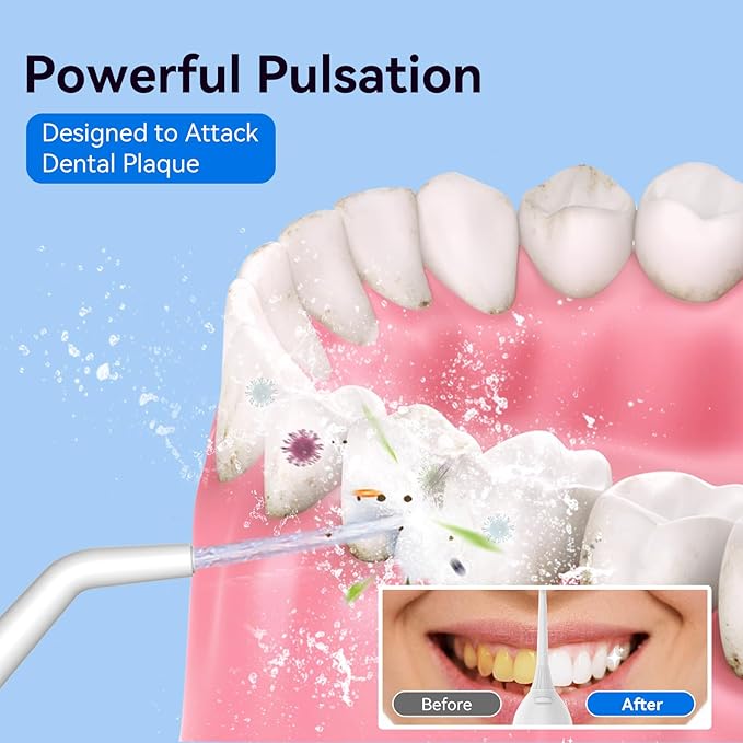 Cordless Portable Water Flosser with 300ML Tank: Rechargeable Oral Irrigator with 5 Tips for Travel, Braces Care and Sensitive Gums, IPX7 Waterproof Teeth Cleaning Device(Blue