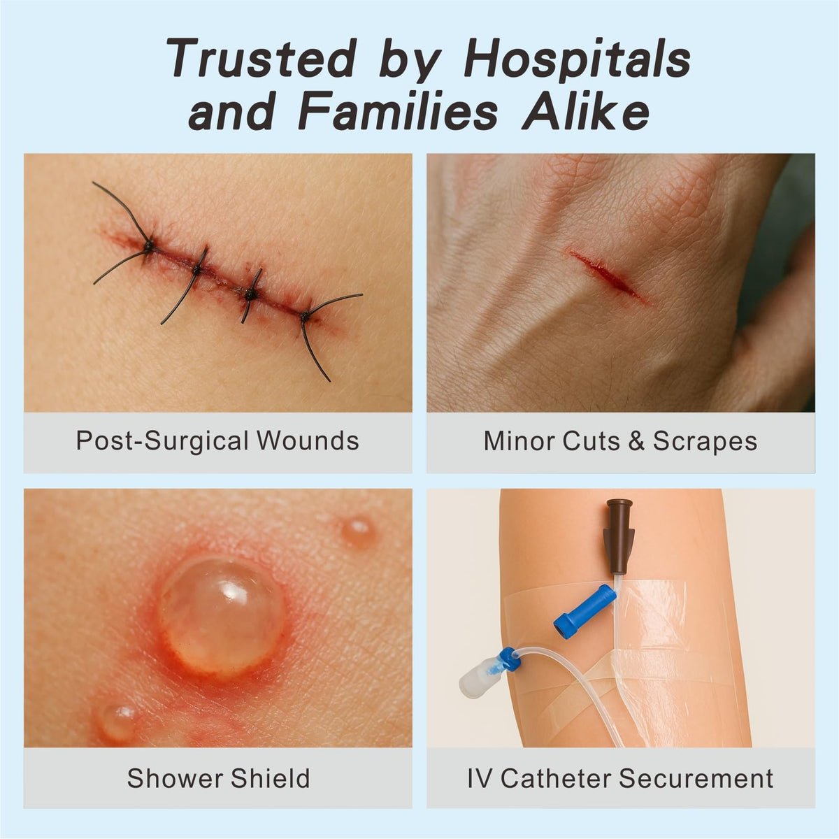 HTLARY Waterproof Transparent Film Dressing with Absorbent Pad 50-Pack Sterile Adhesive Bandages Post-Surgical Wound Cover, Protective Barrier for Sensitive Skin (2.3‘’x2.7‘’)