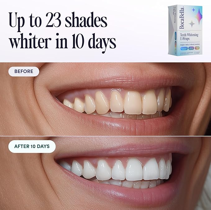 Boca Bella Teeth Whitening U-Wraps – 10 Treatments – 15% Hydrogen Peroxide, Enamel-Safe, No Harsh Sensitivity – Patented Strip Design with Aloe, Calendula & Peppermint – Fast, Even Whitening