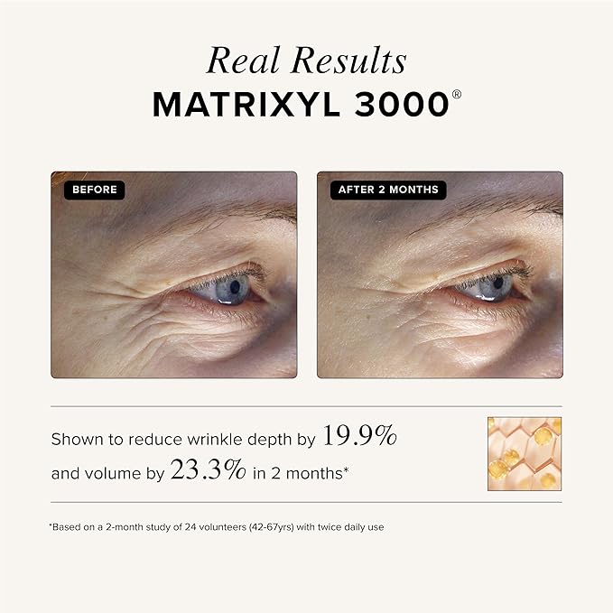 Asterwood Triple Repair Matrixyl 3000 + Argireline + Hyaluronic Acid + Vitamin C Serum for Face - Anti-Aging, Collagen Boosting, Hydrating - Fragrance-Free - 4 Fl Oz