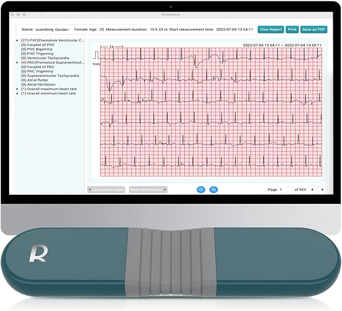 Livenpace 1-Lead Heart Health Monitor at Home, Portable 24 Hours Chest Lead Device with Free AI Analysis & PC Report, Rechargeable Recorder, HHM1